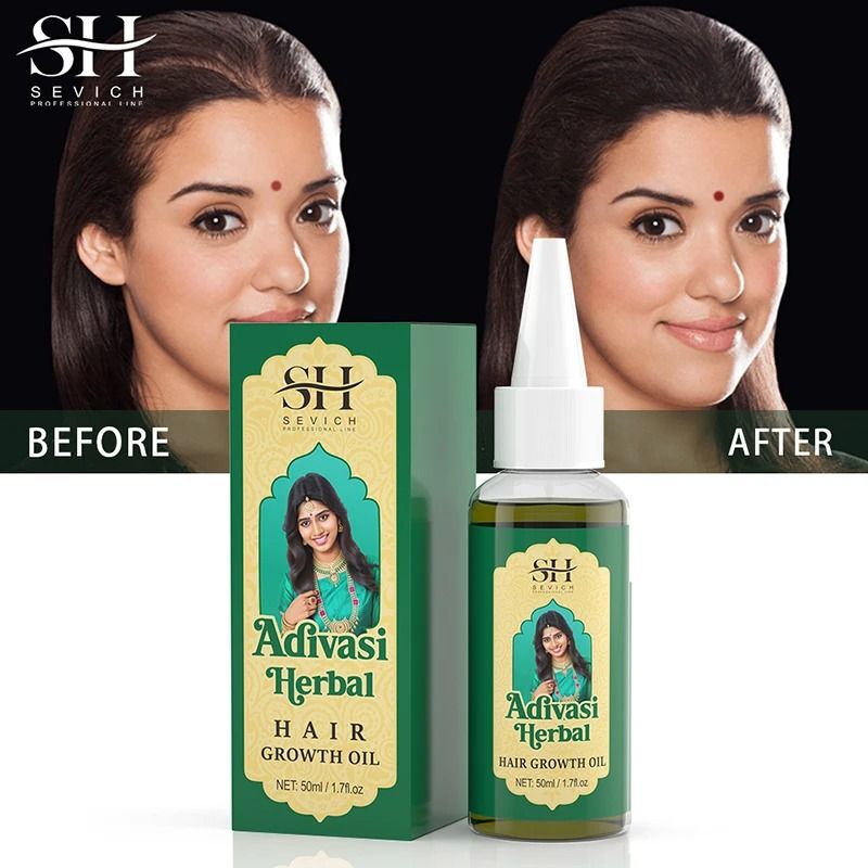 Adivasi Herbal Hair Growth Oil  Ayurvedic Anti Hair Loss Treatment For Stronger Thicker Hair 5