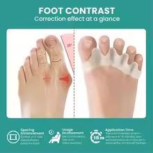 Silicone Finger  Toe Protector  Flexible Toe Separators Straighteners  Bunion Pain Relief FootCare  1