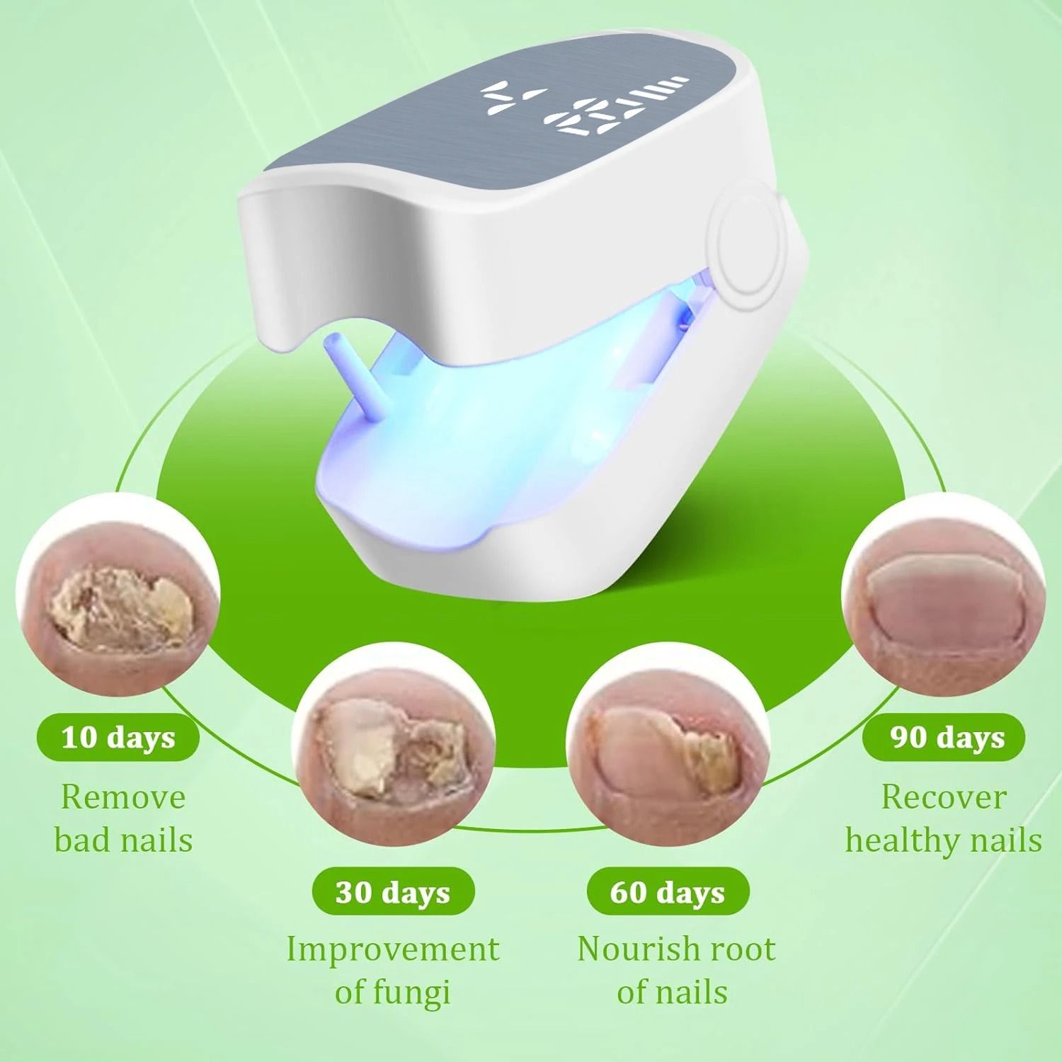 LED Laser Nail Fungus Treatment Device With Infrared And Blue Light Therapy 3