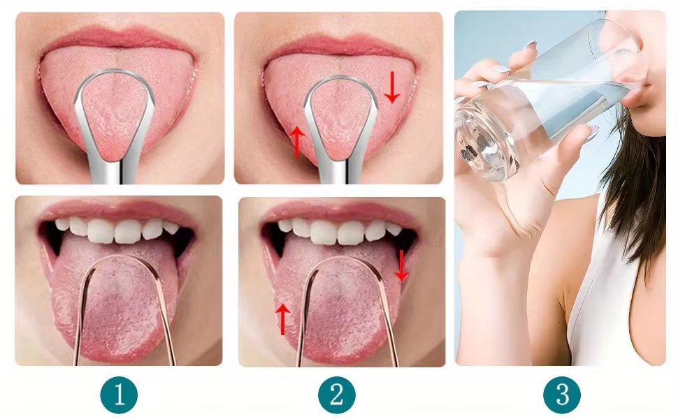 PureClean Stainless Steel SpoonShaped Tongue Scraper Set 5
