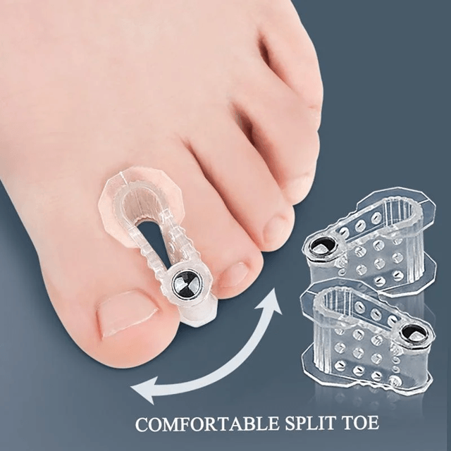 AlignEase Bunion Corrector  Toe Spreader Set  Hallux Valgus Relief Tool 2
