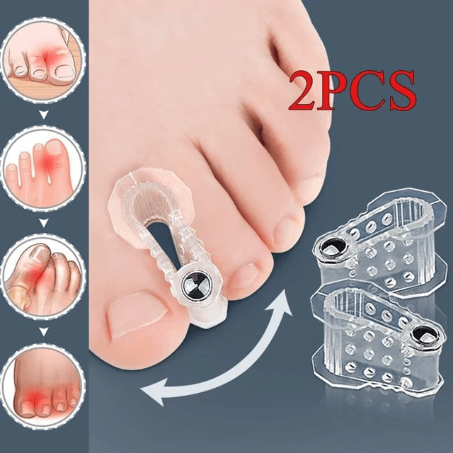 AlignEase Bunion Corrector & Toe Spreader Set – Hallux Valgus Relief Tool