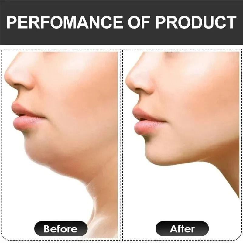 U Shape Jaw Exerciser Facial Muscle Training Device 6