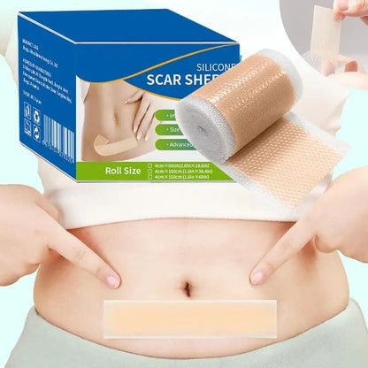 Soft Reusable Silicone Scar Tape For Gentle Scar Care 2