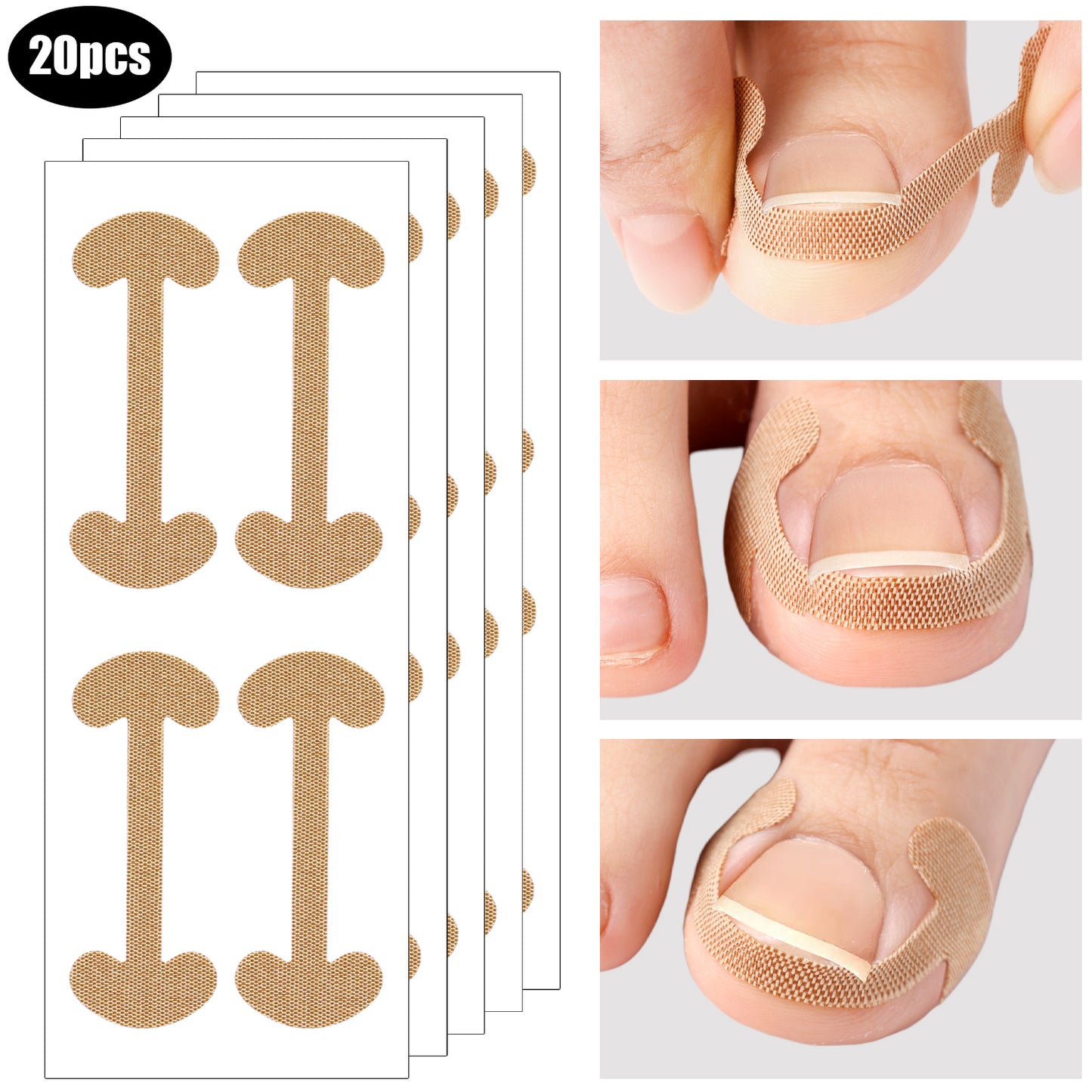 Lasting Adhesion Waterproof Nail Correction Strips, Professional Toe Care Pedicure Tools, Stickers Elasticity