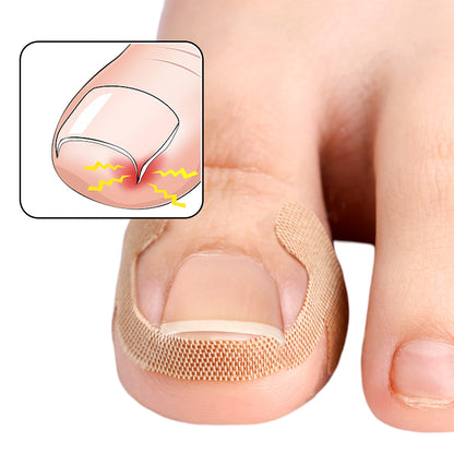 Lasting Adhesion Waterproof Nail Correction Strips, Professional Toe Care Pedicure Tools, Stickers Elasticity