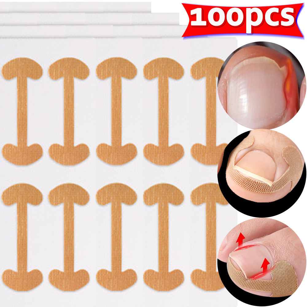 Lasting Adhesion Waterproof Nail Correction Strips, Professional Toe Care Pedicure Tools, Stickers Elasticity