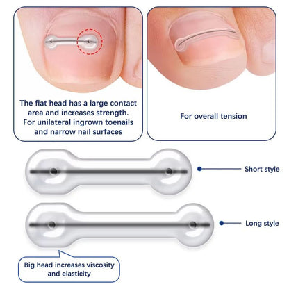 Ingrown Toenail Correction Patch Set Elastic Toe Nail Brace Pedicure Tool 1