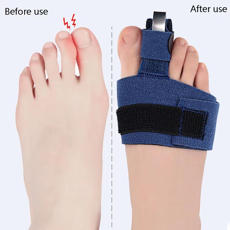 Toe Corrector Bunion Straightener Orthotic Pedicure Sock  Soft Big Toe Hallux Valgus Adjuster 3