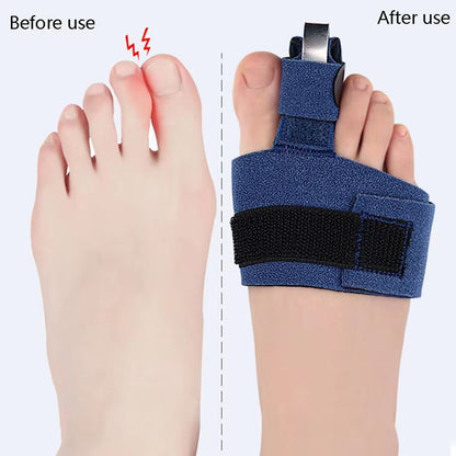 Toe Corrector Bunion Straightener Orthotic Pedicure Sock  Soft Big Toe Hallux Valgus Adjuster 3