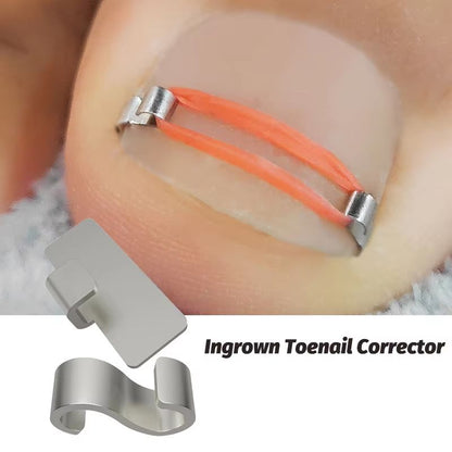 Professional Ingrown Toenail Corrector Tool Set – Pedicure Treatment & Foot Care Kit