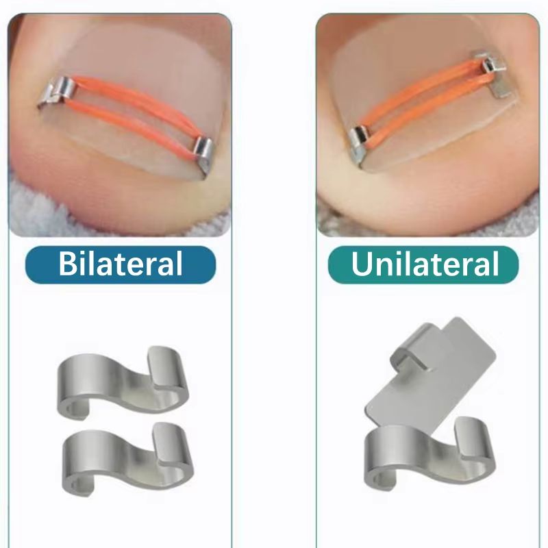 Professional Ingrown Toenail Corrector Tool Set  Pedicure Treatment  Foot Care Kit 1