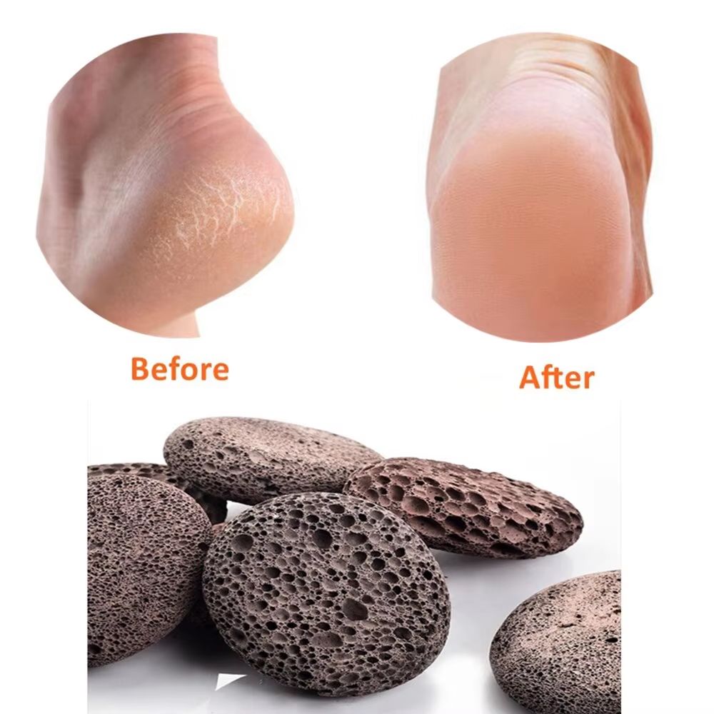 Natural Pumice Stone Foot  Body Scrubber For Callus Removal 1