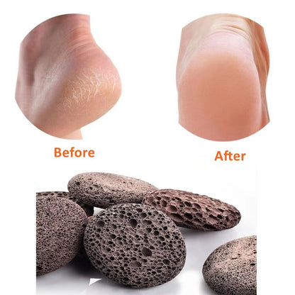 Natural Pumice Stone Foot  Body Scrubber For Callus Removal 1