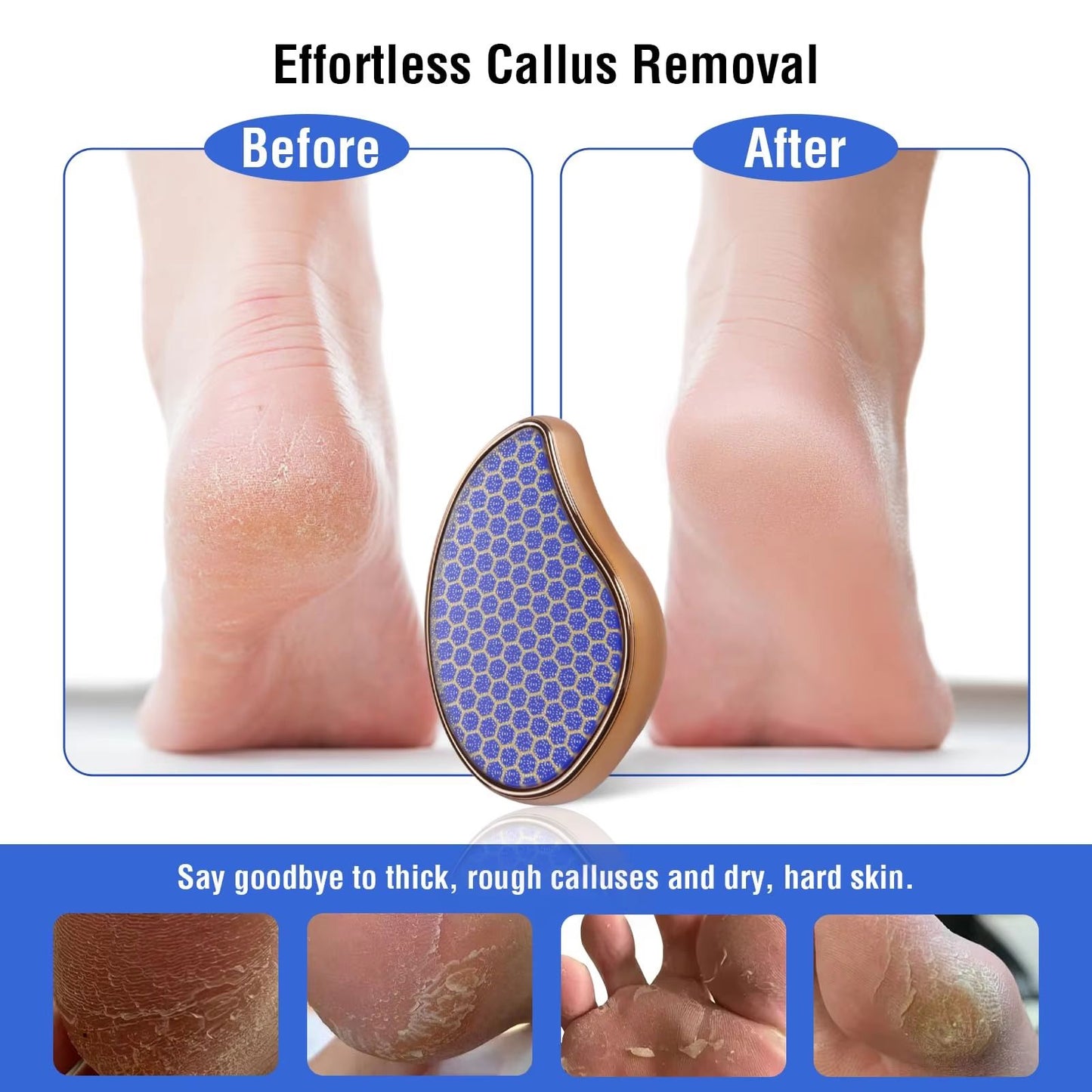Nano Glass Foot File Callus Remover  Gentle Dead Skin Exfoliator For Smooth Heels 1