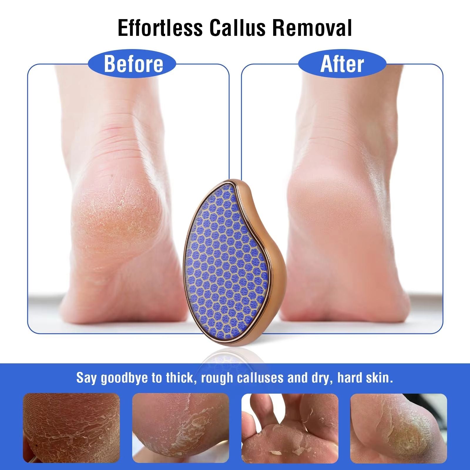 Nano Glass Foot File Callus Remover  Gentle Dead Skin Exfoliator For Smooth Heels 1