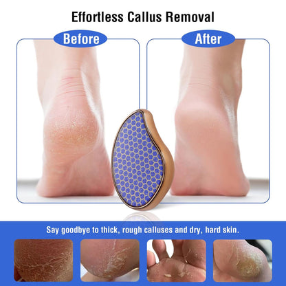 Nano Glass Foot File Callus Remover  Gentle Dead Skin Exfoliator For Smooth Heels 1