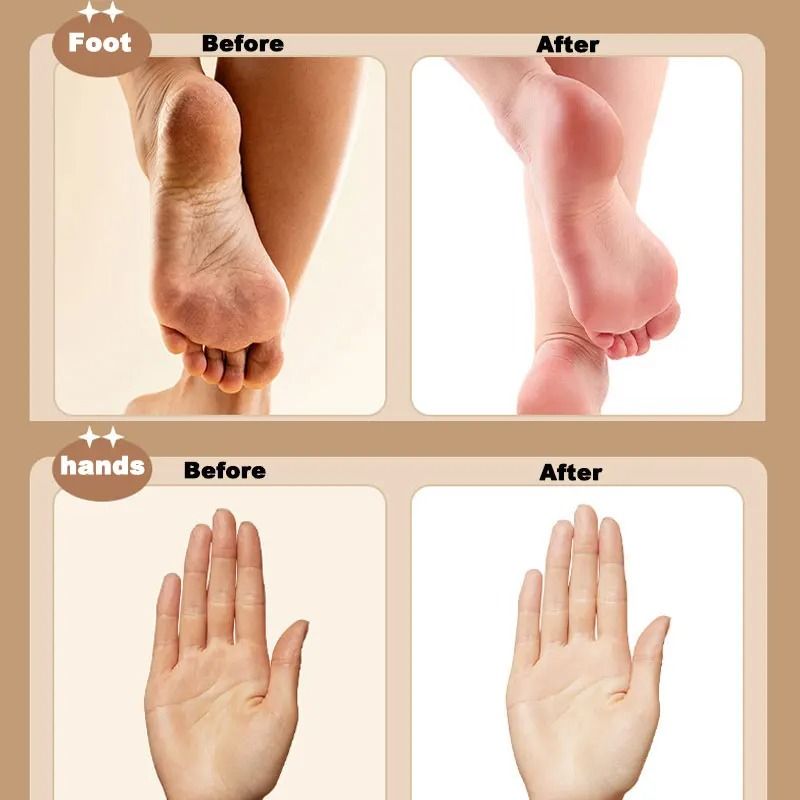 3 In 1 Electric Foot File Callus Remover For Smooth Skin 2
