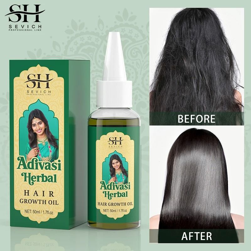 Ayurvedic Hair Growth Oil Organic Adivasi Hair Regrowth And Thickening Serum 1