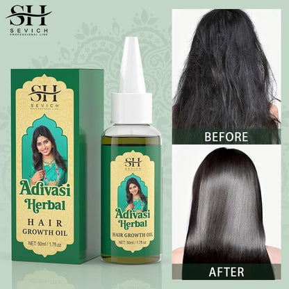 Ayurvedic Hair Growth Oil Organic Adivasi Hair Regrowth And Thickening Serum 1