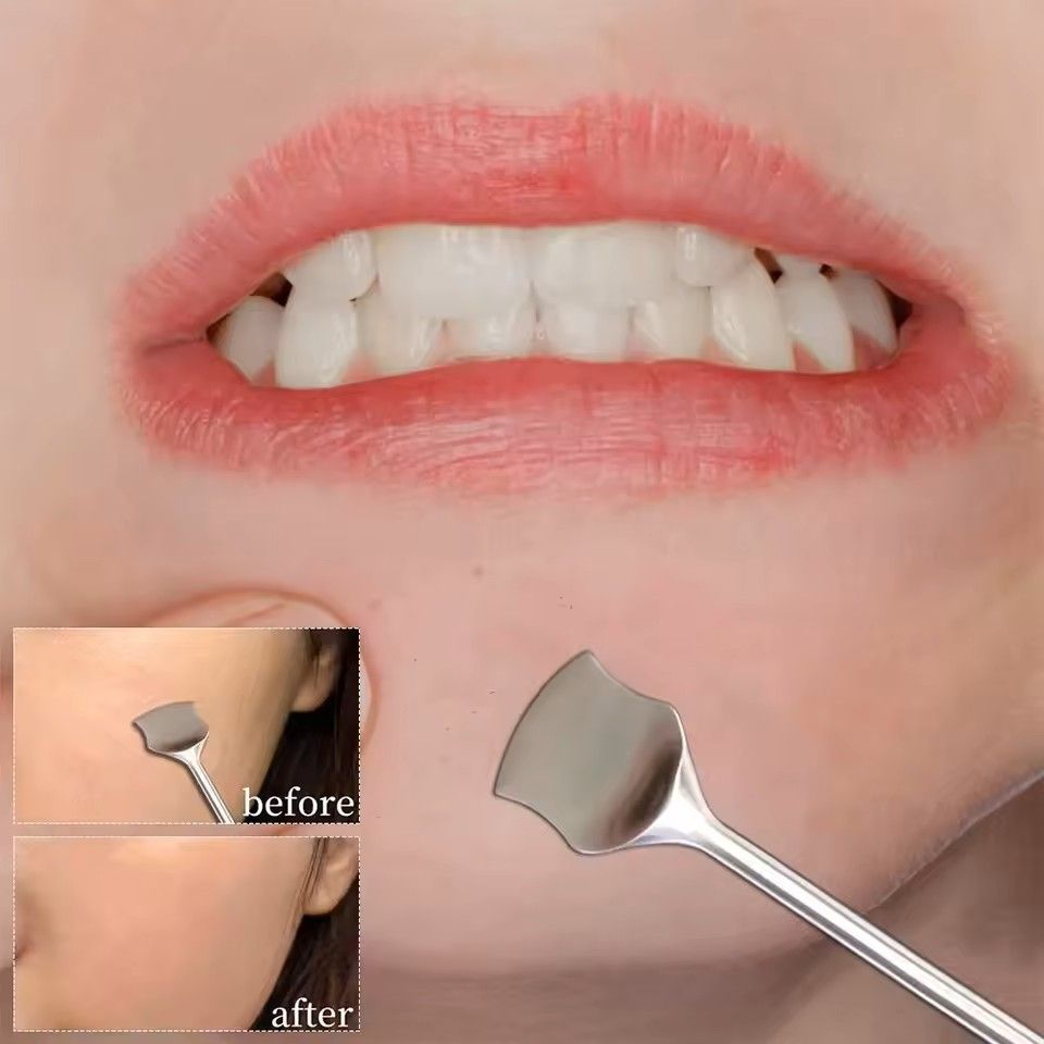 304 Stainless Steel Blackhead Cleaning Scraper Double Head Pimple Remover Facial Care Beauty Tool 1