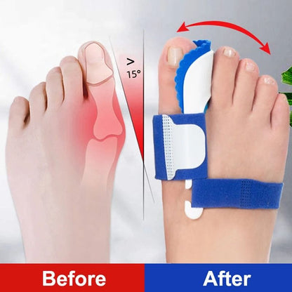 Gentle Align Bunion Corrector Brace for Toe Realignment