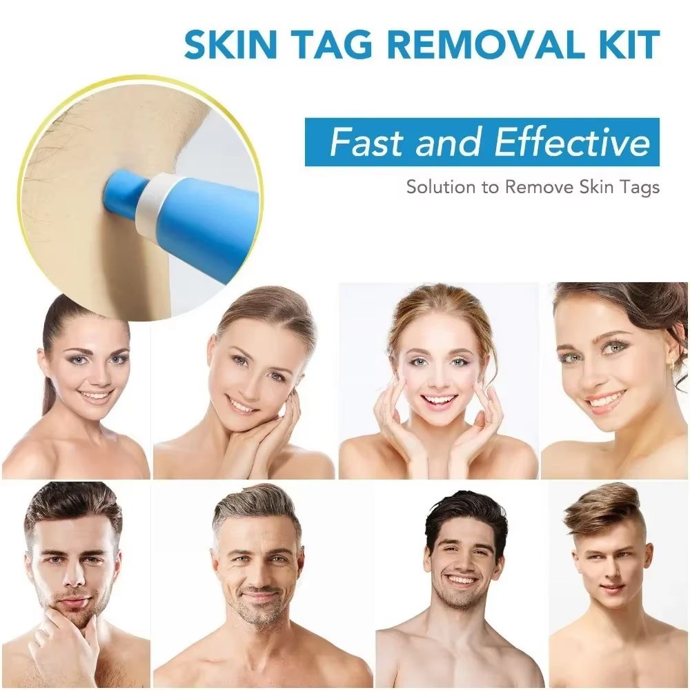 2 In 1 Painless Skin Tag And Mole Removal Kit 2