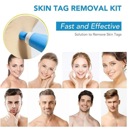 2 In 1 Painless Skin Tag And Mole Removal Kit 2