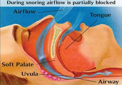 Anti Snoring Nose Clip Set For Better Breathing And Restful Sleep 3