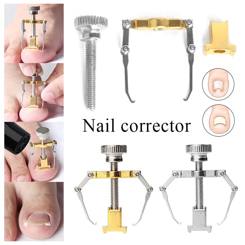 Toenail Straightening Clip Ingrown Toenail Lifter Stainless Steel Foot Care Corrector 3