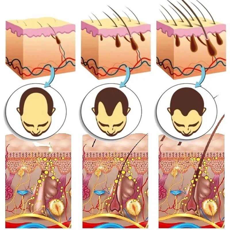 Ginger Hair Growth Serum 7 Day Fast Regrowth Anti Hair Loss Scalp Repair And Root Nourishing Care 2