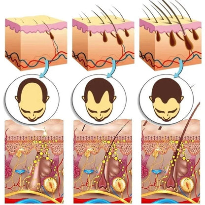 Ginger Hair Growth Serum 7 Day Fast Regrowth Anti Hair Loss Scalp Repair And Root Nourishing Care 2