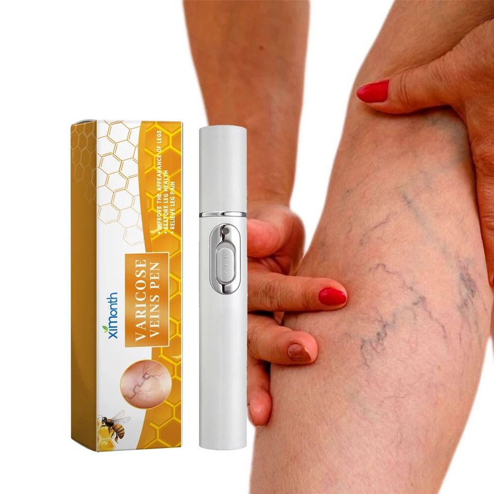 Varicose Vein Relief Pen for Soothing Leg Discomfort and Promoting Circulation