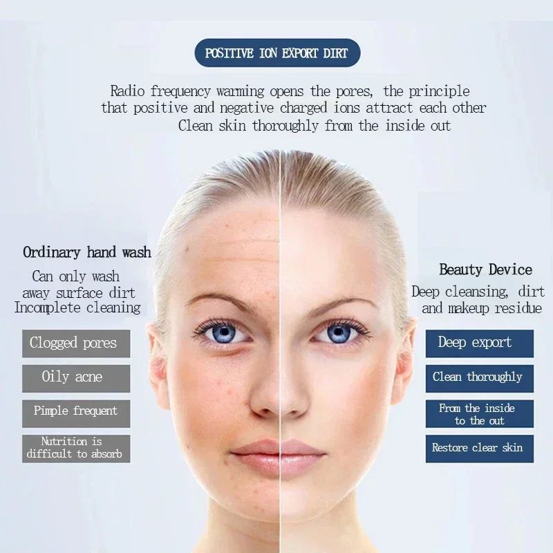 Ionic AntiWrinkle Face Massager  Electronic Skin Tightening  Whitening Beauty Device 2