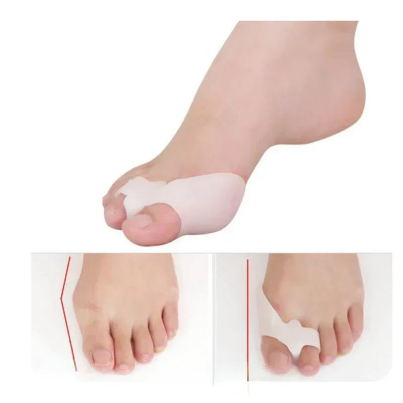 Silicone Gel Two Hole Toe Separator Thumb Valgus Protector Hallux Valgus Guard Bunion Adjuster For  1