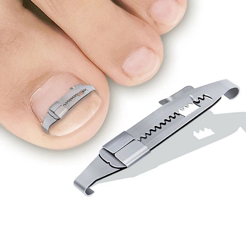 Professional Ingrown Toenail Corrector Tool Foot Care Pedicure Treatment 1