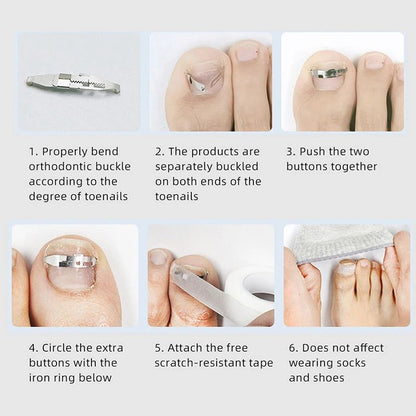 Professional Ingrown Toenail Corrector Tool Foot Care Pedicure Treatment 2