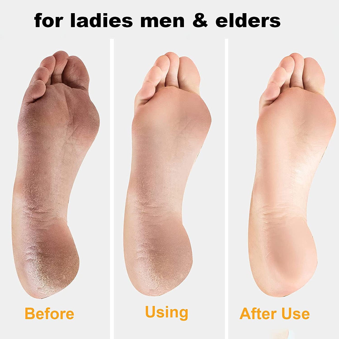 Exfoliating Calluses Brush, Pedicure Tools Heel Scratcher, Stainless Steel Double-sided Foot Sharpening Files Artifact
