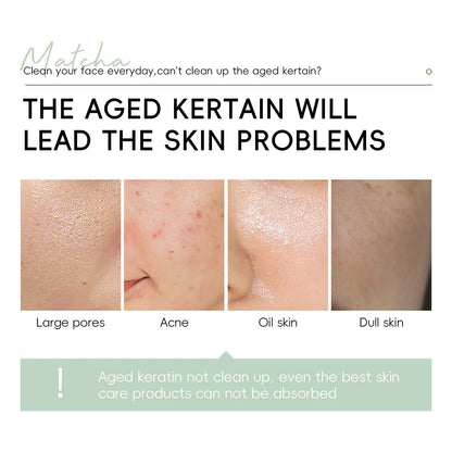 Matcha Exfoliating Gel For Deep Cleansing And Skin Renewal 60g 4