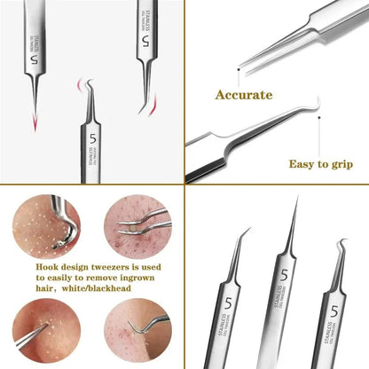 Professional UltraFine No5 Acne  Blackhead Removal Tweezers  Precision Pimple Extractor Tool 4