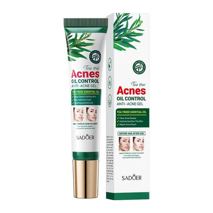 Tea Tree Acne Removing Cream Oil Control Hydrating Facial Gel Skin Care 4