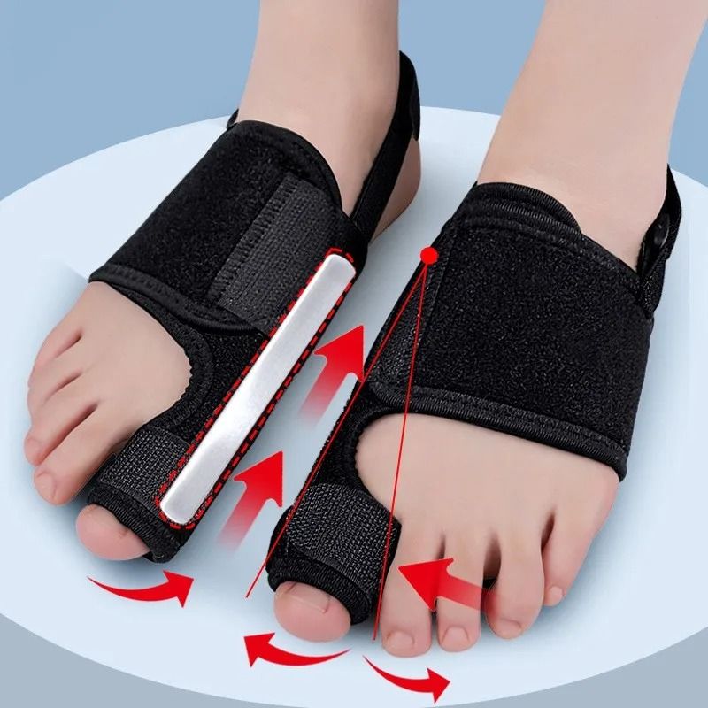 Toe Corrector Orthotic Support For Hallux Valgus Bunion Alignment And Hammer Toe Relief 1